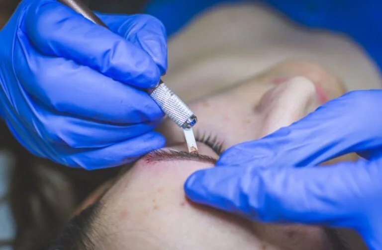 eyebrow-treatments